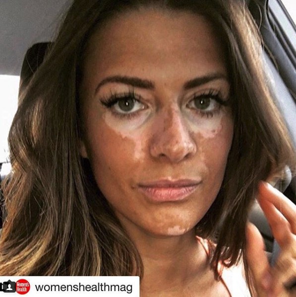 Instagram @breannerice