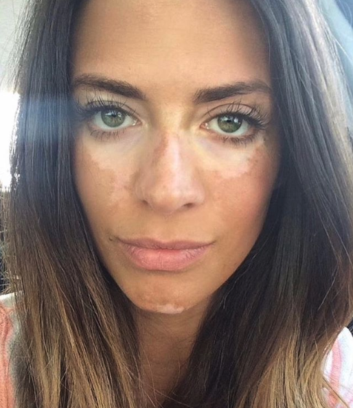 Instagram @breannerice