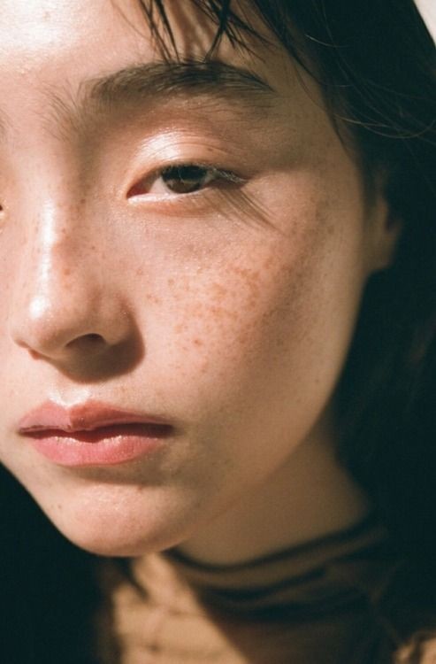 色斑成因不同,包括曬斑,歲月斑,缺水斑和天然斑