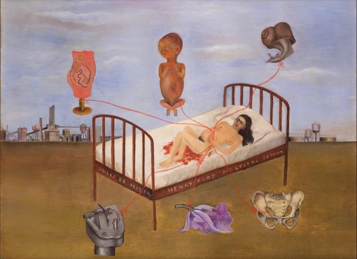 Frida kahlo 用繪畫拆穿傷