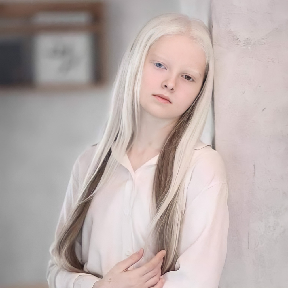 Amina Ependieva-異色症