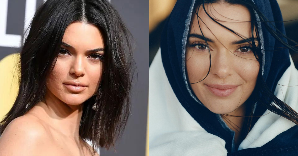 曾因暗瘡而令自尊心受挫的Kendall，早已擺脫了暗瘡肌的困擾。