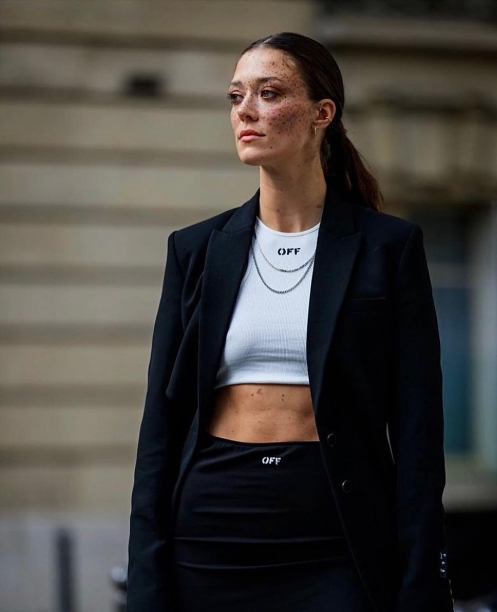 曾經自卑的雀斑反而讓她被看見