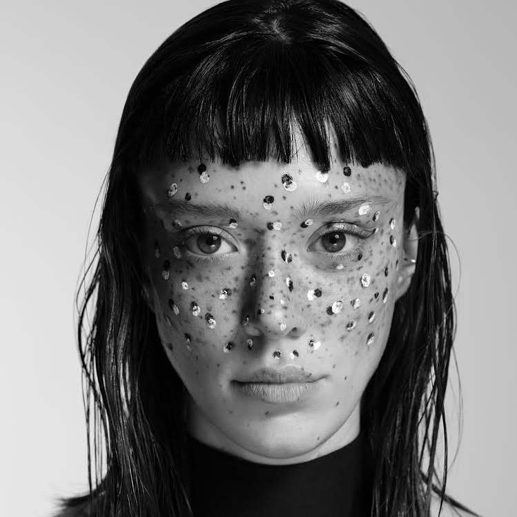 臉上產生了大量咖啡色斑點色素沉澱