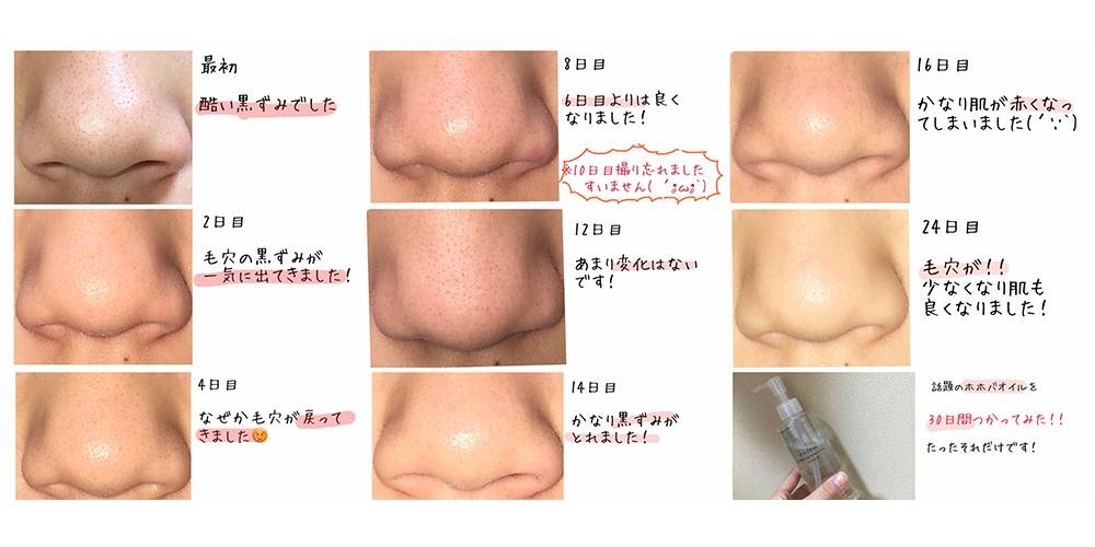 有日本網民實測30日連續使用可巴油去黑頭,效果令人驚喜。