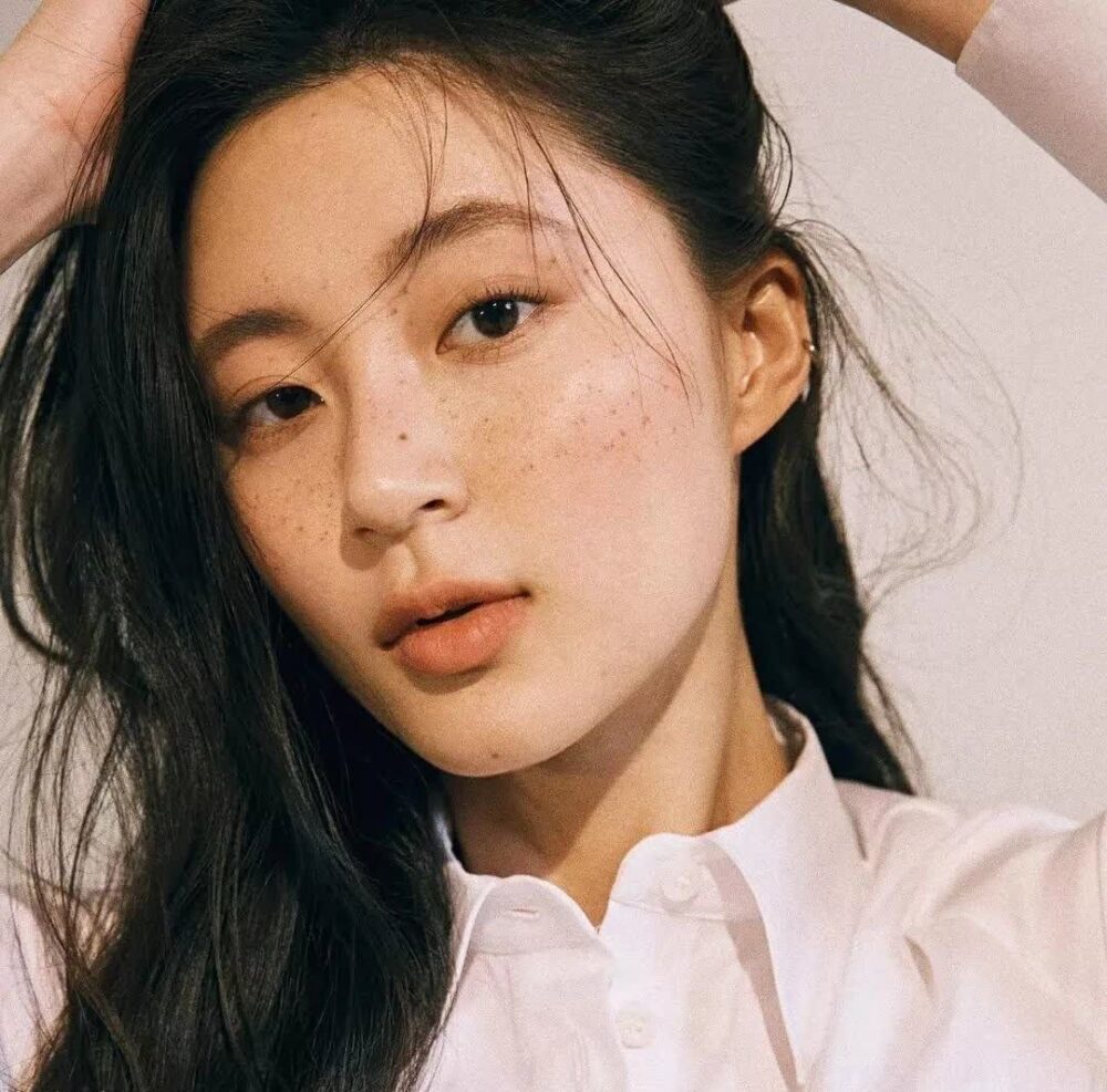 色斑種類根據黑色素沉澱的深淺和成因不同，分為淺層色斑和深層色斑，每種都有獨特的特徵。