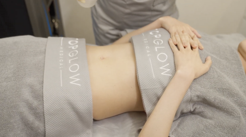 一名女子正在TopGlow Medical進行TotalSculpt™ 全效塑形療程。