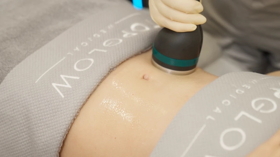 女客人正在進行TotalSculpt™ 全效塑形療程。